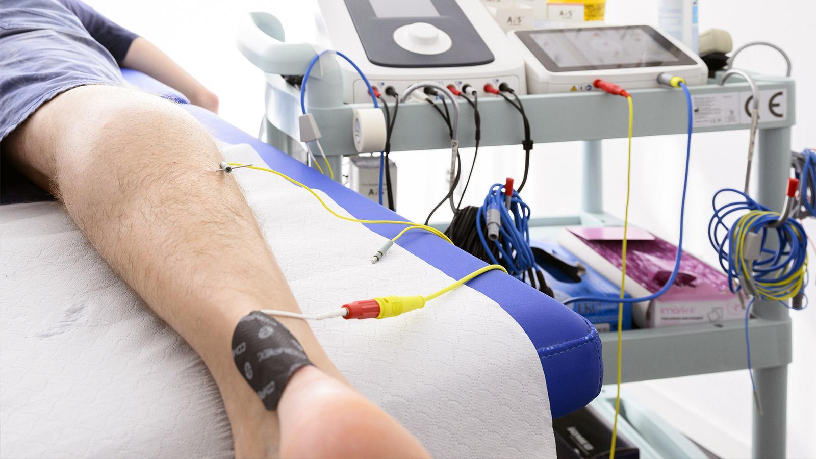 Neuromodulation percutanée échoguidée à La Chaux-de-Fonds